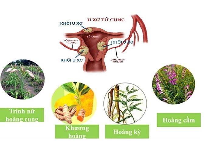 Các thảo dược có tác dụng tốt đối với bệnh u xơ tử cung