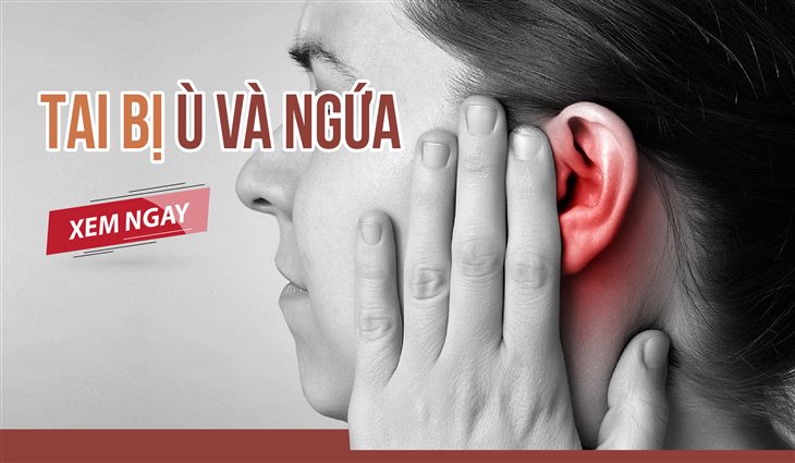 Bị viêm tai giữa dễ gây ù và ngứa tai