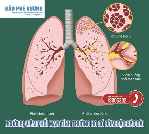   Bệnh phổi mạn tính là tình trạng tắc nghẽn đường thở kéo dài