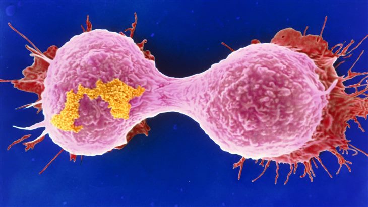 Tế bào ung thư vú hình thành từ việc thức đêm thường xuyên