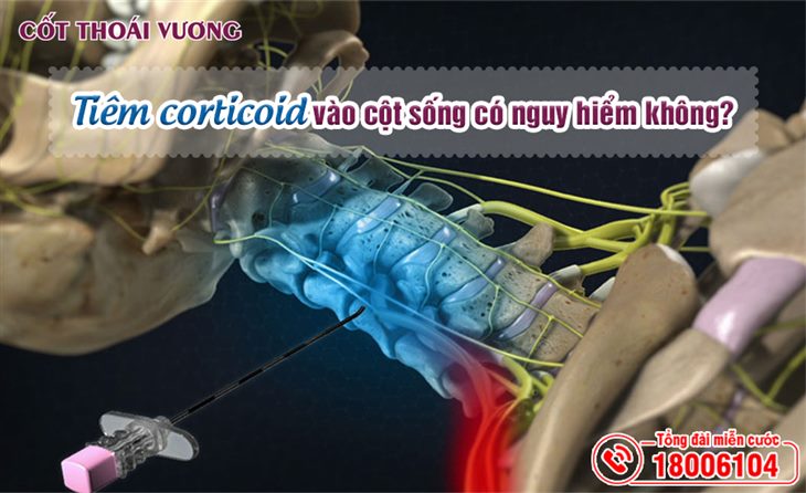 tiem-corticoid-vao-cot-song-co-nguy-hiem-khong