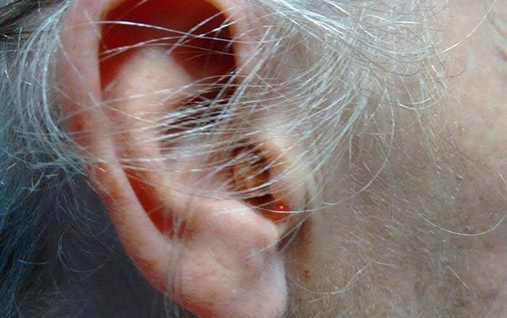 Đeo nút bịt tai giúp bảo vệ thính lực