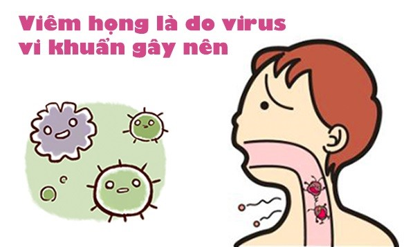 Virus, vi khuẩn tấn công ồ ạt gây viêm họng