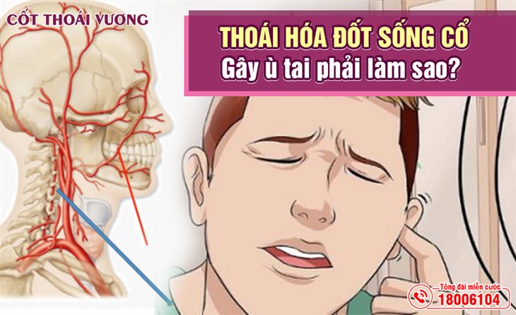 thoai-hoa-dot-song-co-gay-u-tai-phai-lam-sao