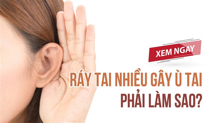 Ráy tai nhiều dễ gây ù tai