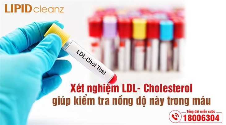 Xét nghiệm LDL-Cholesterol giúp bạn kiểm soát các vấn đề sức khỏe
