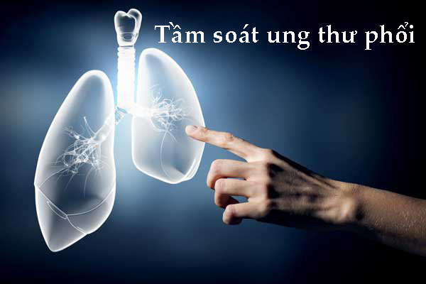 Tầm soát ung thư phổi giúp phát hiện bệnh sớm 