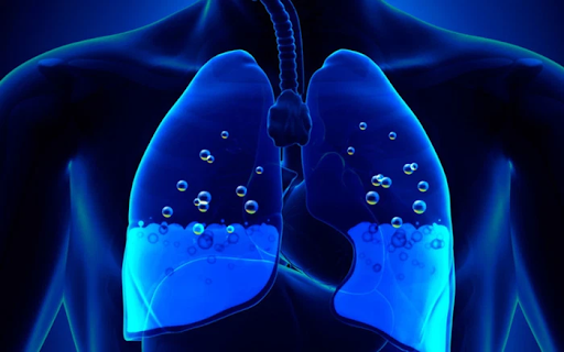 Suy thận mạn có thể gây ra biến chứng phù phổi cấp