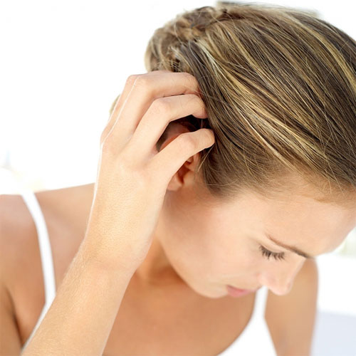 Bệnh vảy nến da đầu gây ngứa ngáy khó chịu trong mùa hè