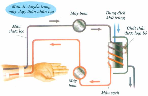 Thông tin về chạy thận người suy thận cần biết 