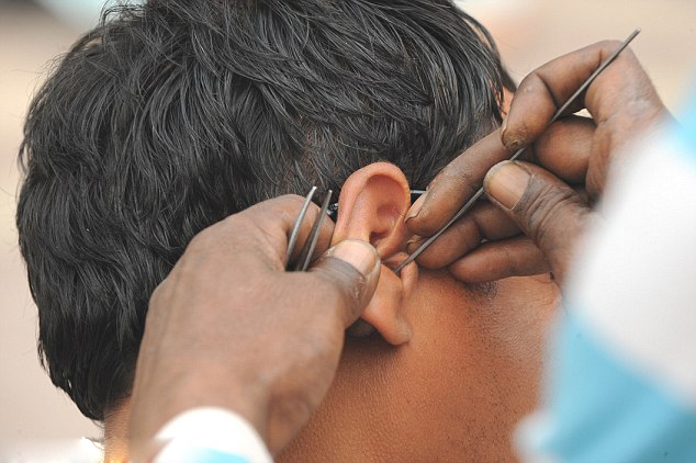 Lấy ráy tai không khoa học có thể gây điếc tai