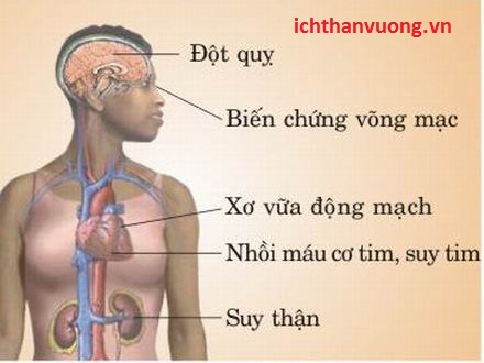 Tăng huyết áp gây suy thận, phá hủy thận như thế nào?