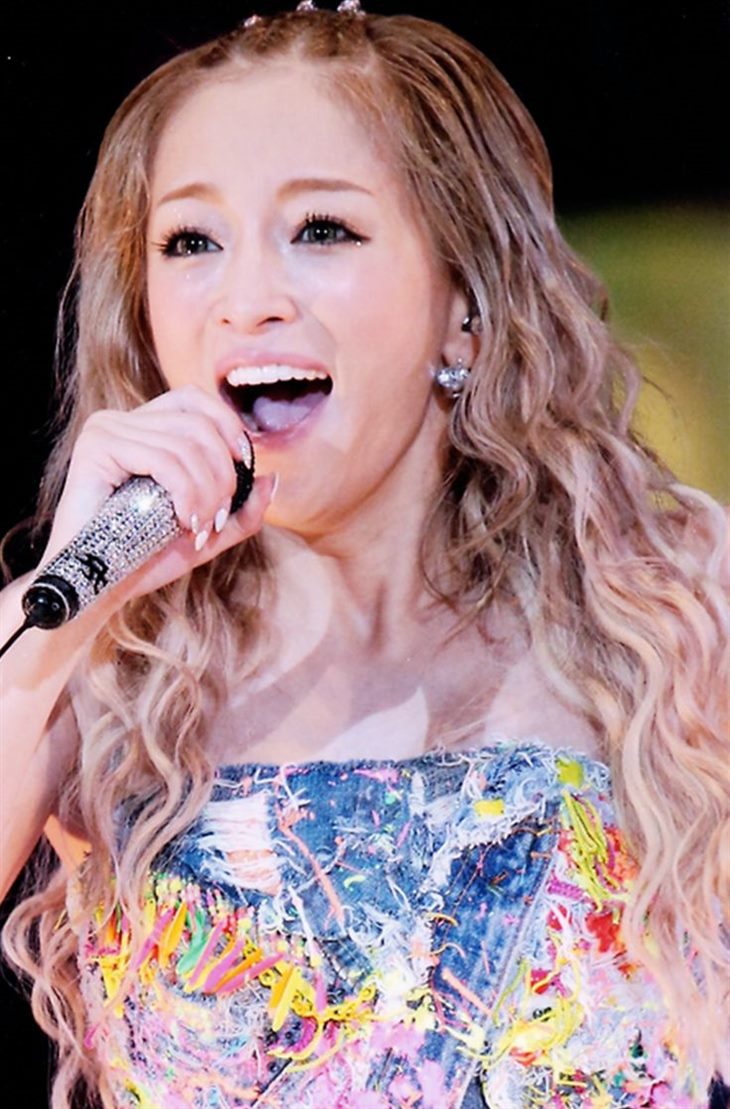 Sốc: Nữ hoàng nhạc pop Nhật sắp bị điếc tai hoàn toàn