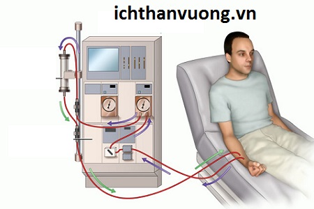 5 câu hỏi về chạy thận người suy thận thường hay thắc mắc cần giải đáp