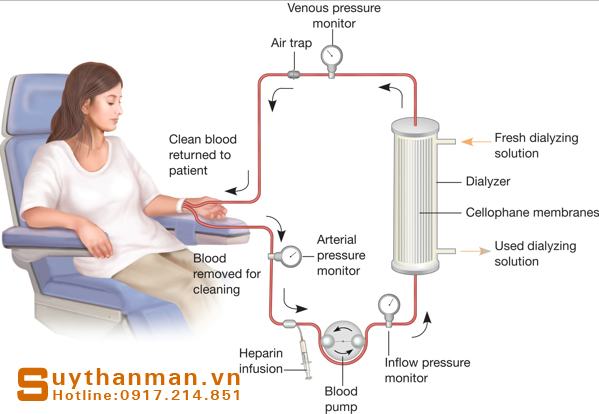 Suy thận không muốn phải chạy thận thì phải làm sao?