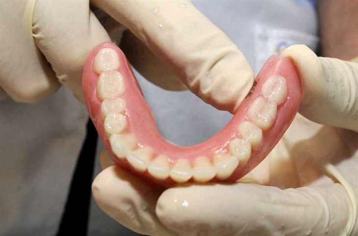 Các loại gia vị sẵn có: Phương pháp chữa đau răng không phải ai cũng b