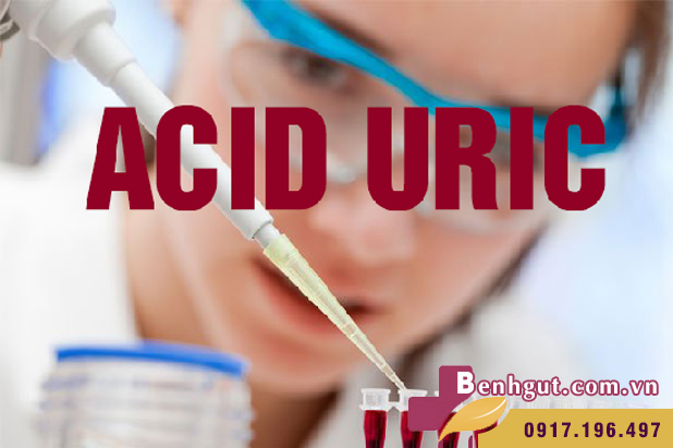 SAI BÉT: "Cứ acid uric cao thì sẽ bị bệnh gút"