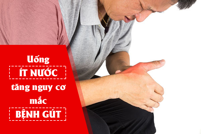 COI CHỪNG: Uống ít nước khiến nguy cơ mắc bệnh gút tăng cao