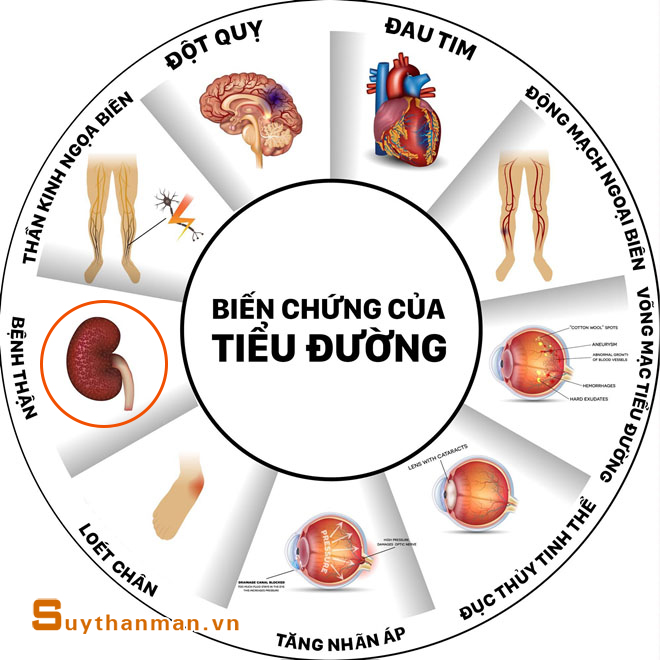 Tại sao SUY THẬN lại là hậu quả của BỆNH TIỂU ĐƯỜNG?