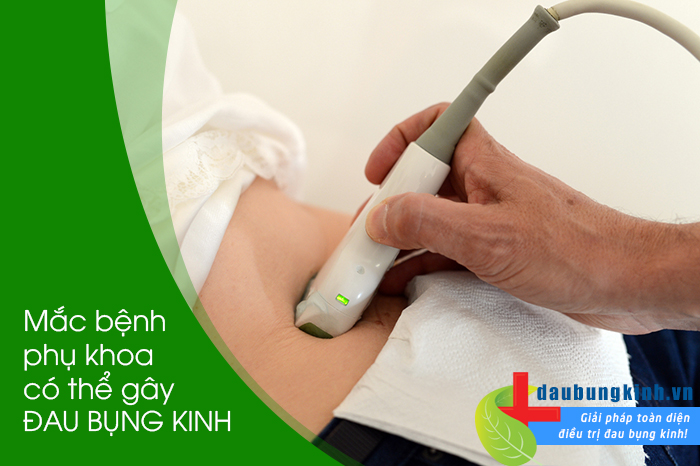 "TỐ GIÁC" 3 bệnh phụ khoa gây đau bụng kinh