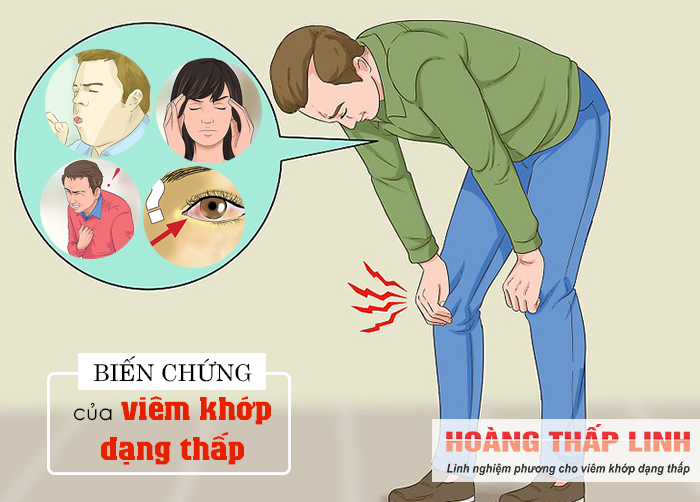 MẤT ĂN MẤT NGỦ vì 4 biến chứng của viêm khớp dạng thấp