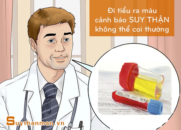 Cảnh giác với máu xuất hiện trong nước tiểu, coi chừng SUY THẬN