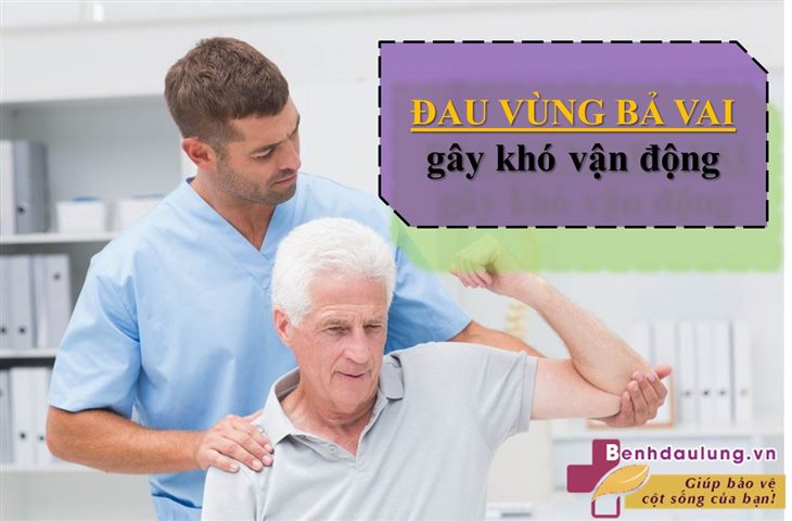 Hóa ra đây là cách trị ĐAU VÙNG BẢ VAI hay hiện nay, bạn muốn biết?