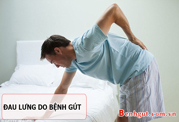 Đau lưng cũng có thể là do BỆNH GÚT - Tại sao lại như vậy?