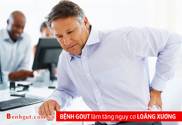 BỆNH GOUT làm tăng nguy cơ LOÃNG XƯƠNG? Tại sao lại như vậy?