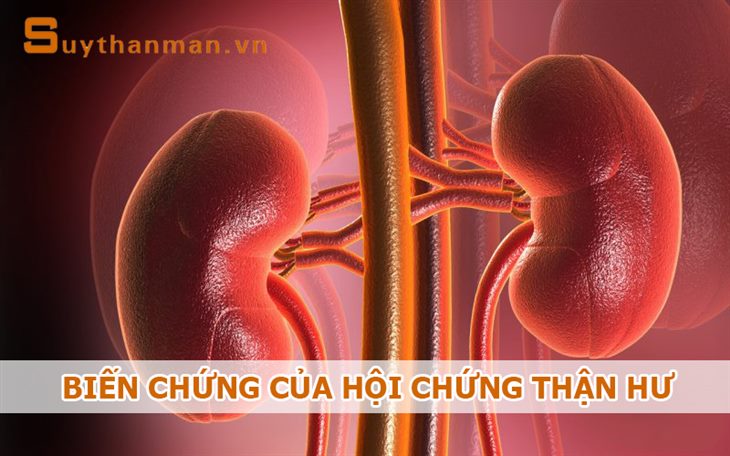 "Lạnh gáy" vì biến chứng nguy hiểm của HỘI CHỨNG THẬN HƯ