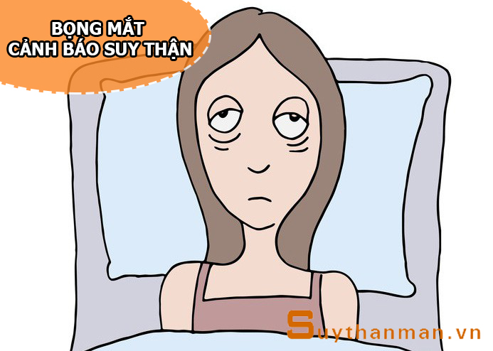 Bọng mắt xuất hiện dai dẳng là "báo động đỏ" SUY THẬN chẳng thể đùa