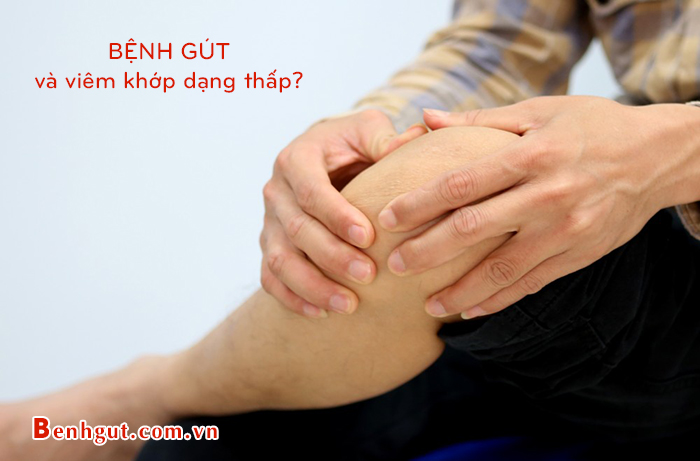 Rất nhiều người nhầm lẫn BỆNH GÚT và viêm khớp dạng thấp. Tại sao?