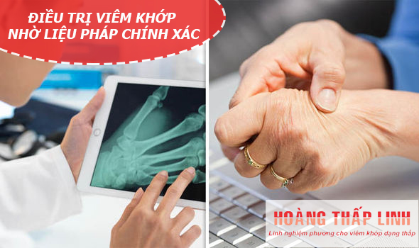 Tin vui: Cải tiến mới trong điều trị VIÊM KHỚP 