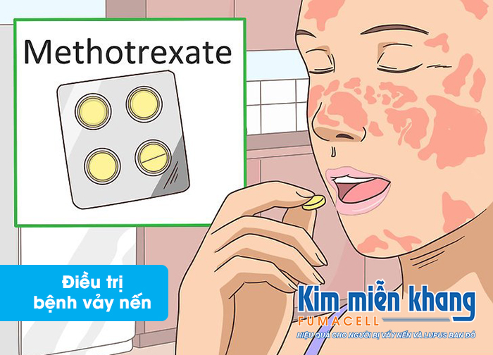 Có nên sử dụng methotrexate để điều trị bệnh vảy nến không?