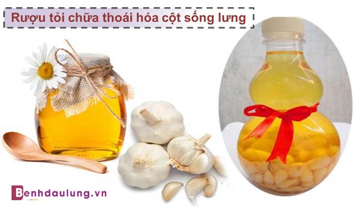 Có nên dùng rượu tỏi chữa thoái hóa cột sống lưng hay không? Đây là câu trả lời!