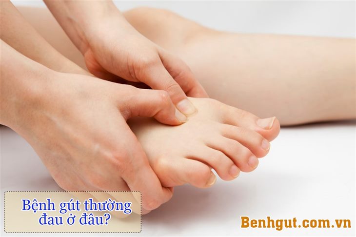 Bệnh gút thường đau ở đâu? Biểu hiện như thế nào?