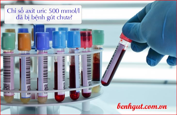 Chỉ số axit uric 500 micromol/l đã bị bệnh gút hay chưa?