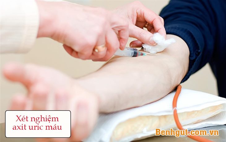 Khi làm xét nghiệm axit uric cần lưu ý những gì? (Axit Uric & Bệnh gút)