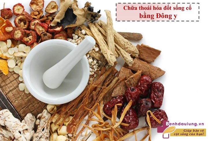 Chữa thoái hóa đốt sống cổ bằng ĐÔNG Y có đem lại hiệu quả LÂU DÀI?