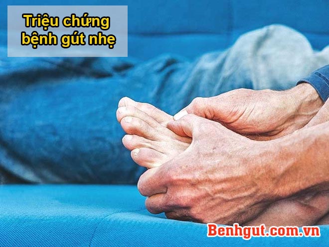 5 triệu chứng bệnh gút nhẹ dễ bị bỏ qua. Xem ngay! 