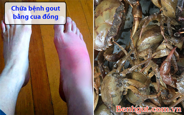 Cách CHỮA BỆNH GOUT bằng cua đồng hiệu quả hơn cả dùng thuốc