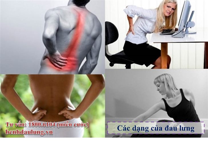 Phân biệt 5 dạng đau lưng mà 2 triệu người Việt Nam mắc mỗi năm