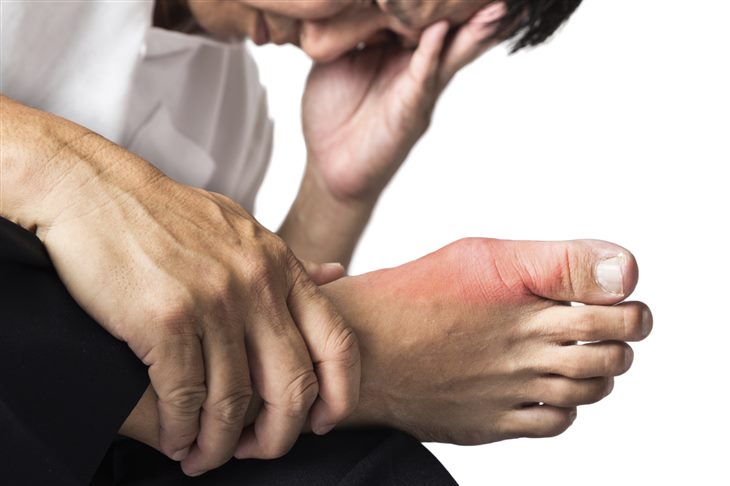 Đau khớp ngón chân cái có phải dấu hiệu của bệnh gút không?