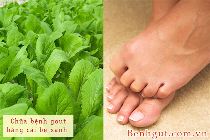 Cách chữa bệnh gout bằng cải bẹ xanh. Đừng bỏ lỡ!