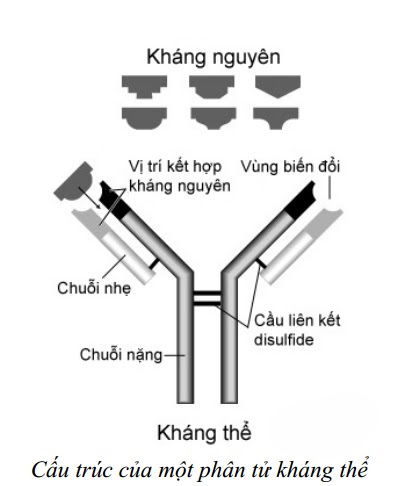 VIÊM CẦU THẬN CẤP là bệnh tự miễn có đúng không? XEM NGAY câu trả lời tại đây!