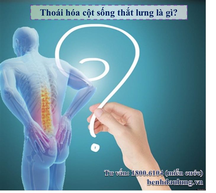 Thoái hóa cột sống thắt lưng là gì? Quan điểm của y học cổ truyền và hiện đại đánh giá như thế nào?