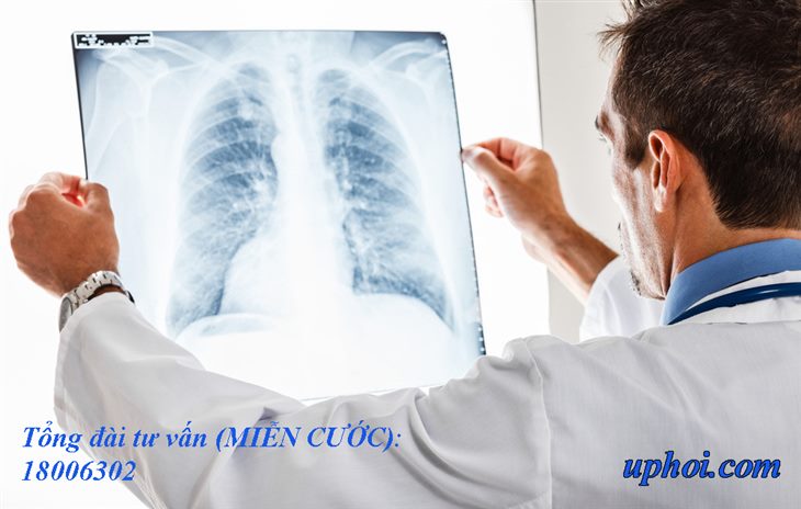 Để chẩn đoán u phổi cần phải làm những xét nghiệm gì?