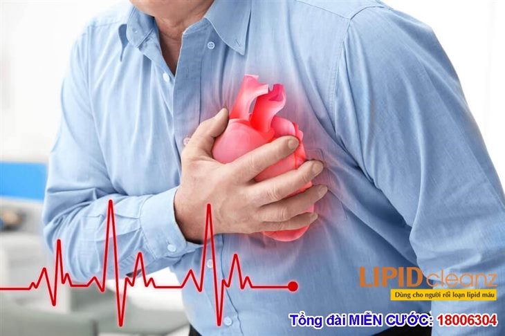 Cải thiện triệu chứng rối loạn lipid máu hiệu quả, an toàn nhờ thảo dược