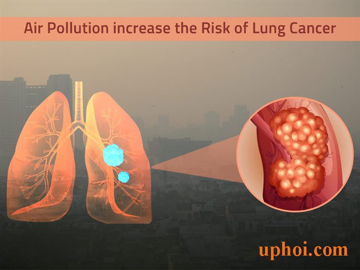 Ung thư phổi di căn đến những cơ quan nào? XEM NGAY!