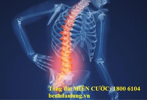 Các biện pháp giúp cải thiện vận động cho người bị thoái hóa cột sống thắt lưng là gì?